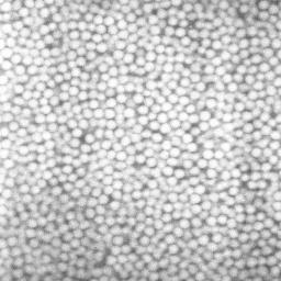 black and white image of colloidal particles